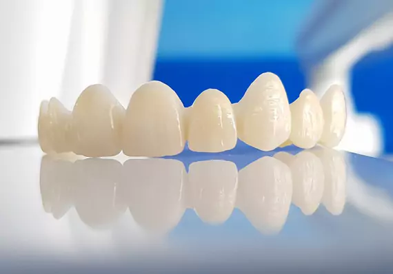 Dental Crowns and Tooth Caps at Impressionz Dental Care